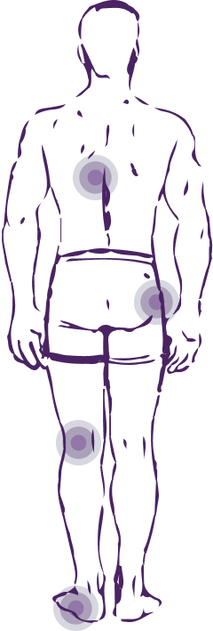 Точки на теле в которых возникают боли при болезни