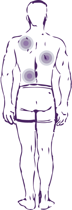 Точки на теле в которых возникают боли при болезни