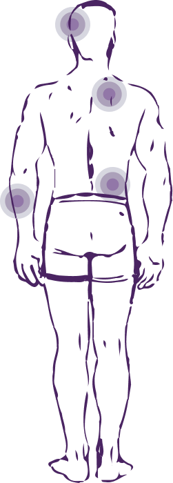 Точки на теле в которых возникают боли при болезни